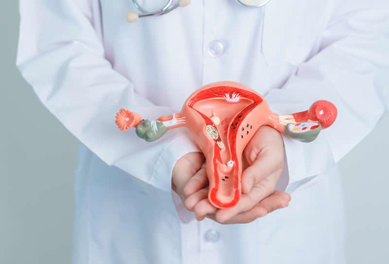 O papel dos exames de imagem no diagnóstico da Endometriose
